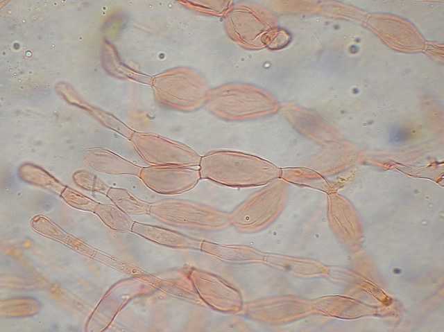 Funghi cittadini
